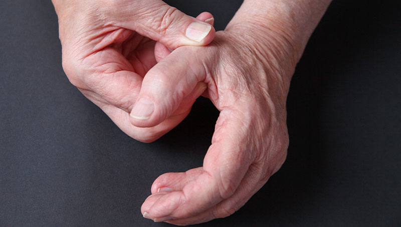 Man holding his thumb in pain due to basal joint arthritis